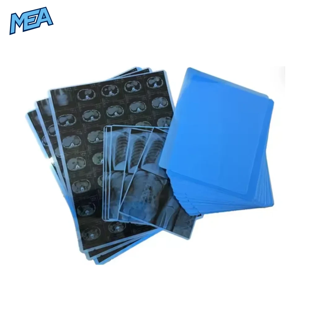 A4 A3 Size Medical Film, Radiology, Laser Printed Film, Inkjet Blue Film, Dental CT Fracture, DRCR X-Ray, MR Magnetic Resonance 1 A4 A3 medical X-ray film blue inkjet laser PET sheet for CT MRI DR CR imaging