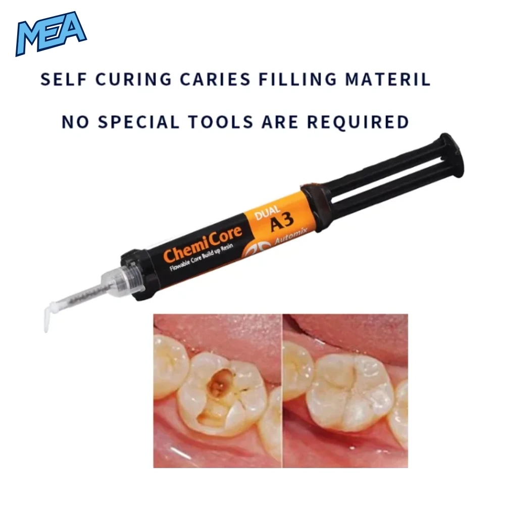 Caries Filling Material Tooth Repair Kit Self Cure Resin Teeth Cavities Restoration Permanent Filler Supplies Automix 1 ChemiCore Dual A3 self-cure caries filling material automix syringe with before and after tooth cavity repair result