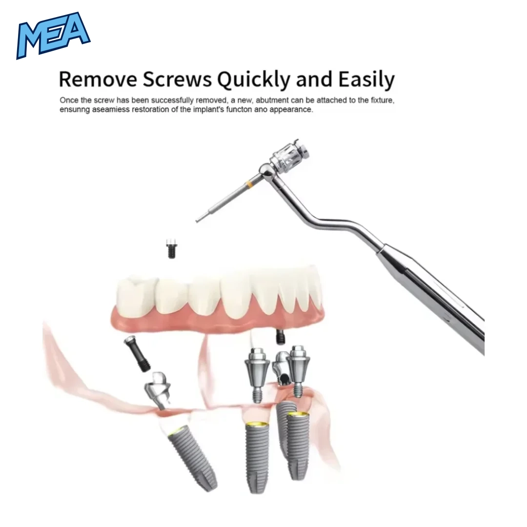 Universal Dental Implant Removal Kit 1 Set Damaged Screw Extractor 4 Fractured dental implant screw removal using screw extractor tool