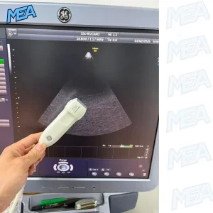 GE 3SC-RS phased array ultrasound probe for cardiac imaging with GE ultrasound system display