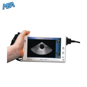 Mcube BioCon-700 portable bladder scanner ultrasound device for non-invasive bladder volume measurement in hospitals and urology clinics