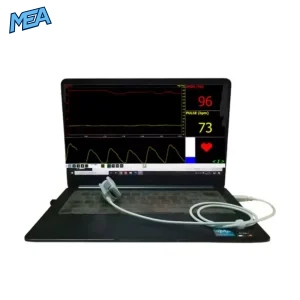 PC based pulse oximeter ST-T130-01 connected to laptop showing live SpO2 96% and pulse rate 73 bpm waveform