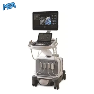 Philips EPIQ Elite ultrasound system with high resolution display