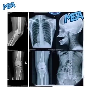 Radiology X-ray film A4 A3 digital medical imaging sheet for hospital CT MRI reports