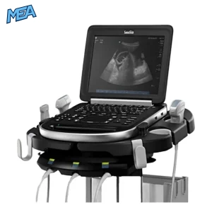 Sonosite Edge II portable ultrasound machine with rC60xi ICTx 15-C and L38xi transducers